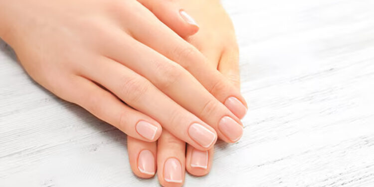 Kuku Berubah: Kenali Tanda Awal Penyakit