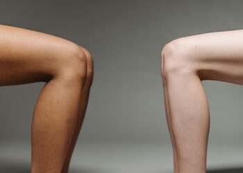 petua putihkan celah paha