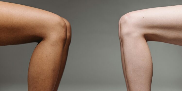 petua putihkan celah paha