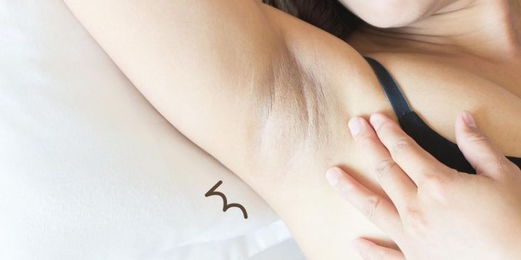 Jom Putihkan Ketiak Yang Hitam Dalam Masa 3 Bulan