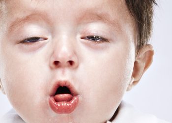 Boleh Mati Jika Tidak Dirawat, Ambil Tahu Apa Itu Batuk Kokol & Gejala