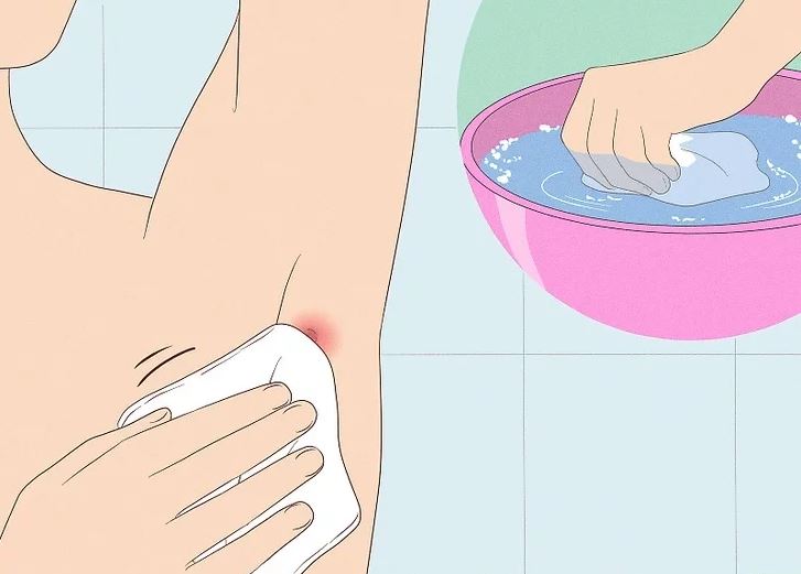 warm compress untuk bisul