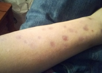 Suami Gagal Bayar Hutang Lebih Setengah Juta, Isteri Diculik, Dirantai & Dicucuh Rokok