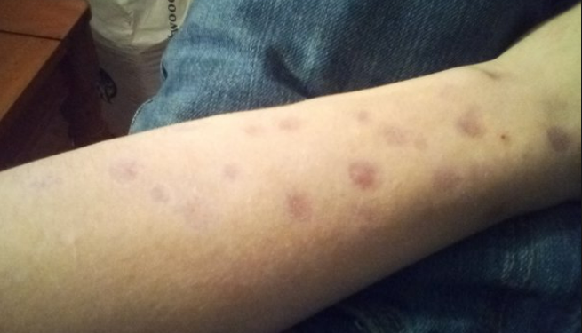 Suami Gagal Bayar Hutang Lebih Setengah Juta, Isteri Diculik, Dirantai & Dicucuh Rokok