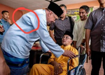 “Nanti Melarat Seluruh Badan Sampai Ke Wajah,” – Papagomo Kata PMX Ada HIV