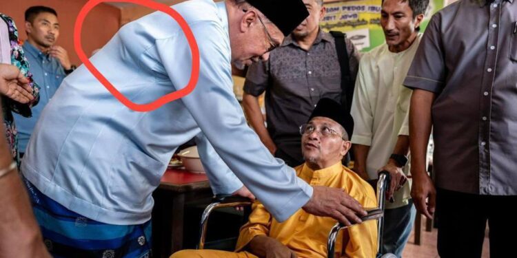 “Nanti Melarat Seluruh Badan Sampai Ke Wajah,” – Papagomo Kata PMX Ada HIV